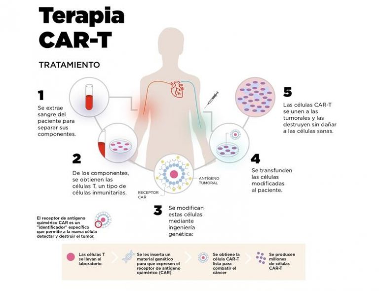 Las células CAR-T controladas por calor destruyen los tumores y evitan la recaída