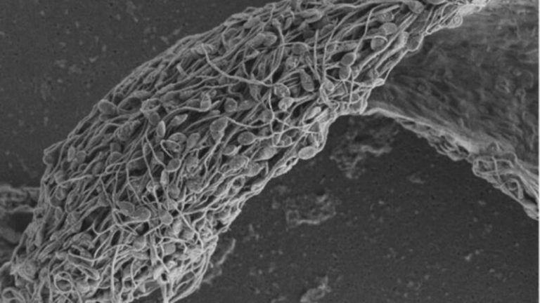 Desarrollan anticuerpos anticonceptivos capaces de inmovilizar a los espermatozoides