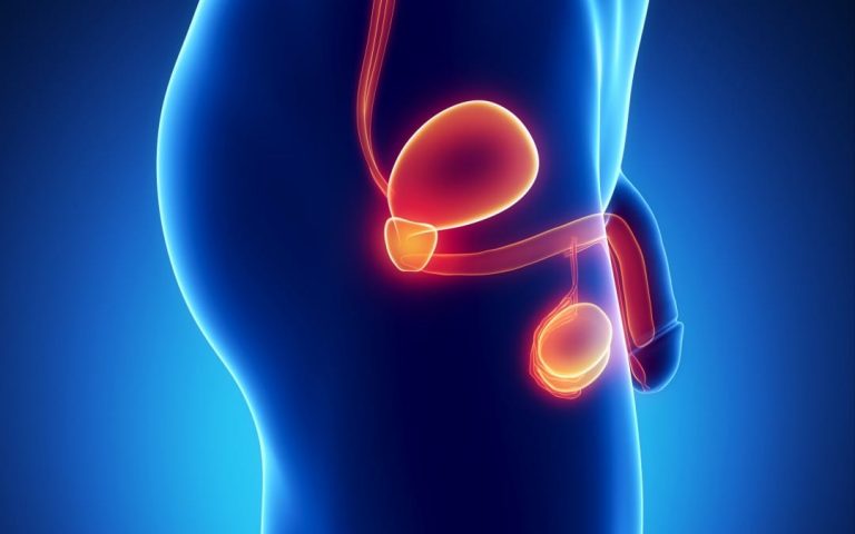 Cáncer de testículos: síntomas que te avisan de que hay un problema