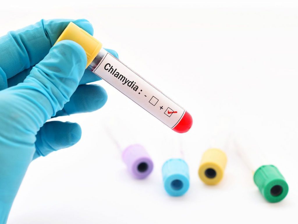 ¿De Qué Forma Se Diagnostica?
