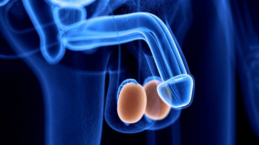 El Tumor Empieza A Dolerle Si Tienes Cáncer De Testículos