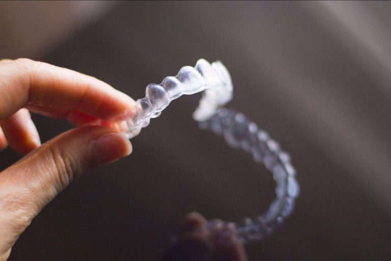 Motivos para escoger la ortodoncia invisible con tecnología alemana Smile Aligner