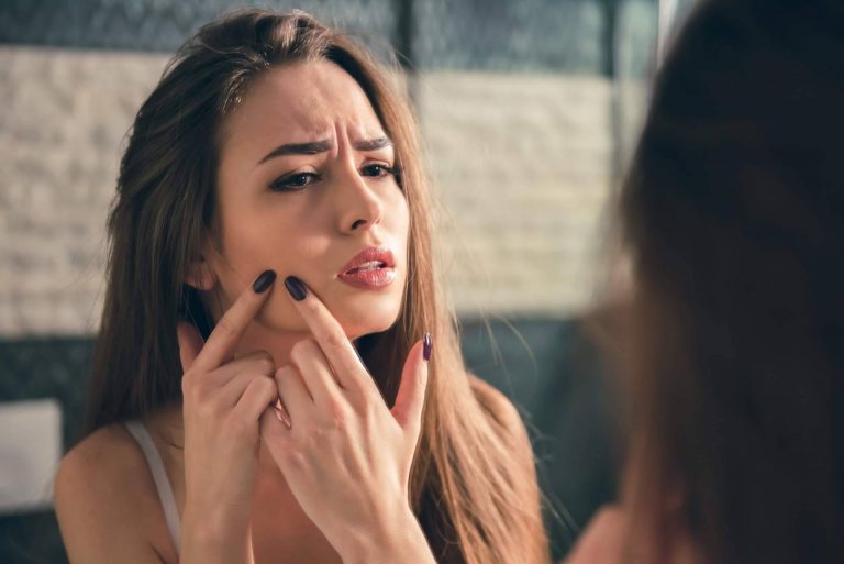 ¿Cómo quitar espinillas y granos con Acné Xero?