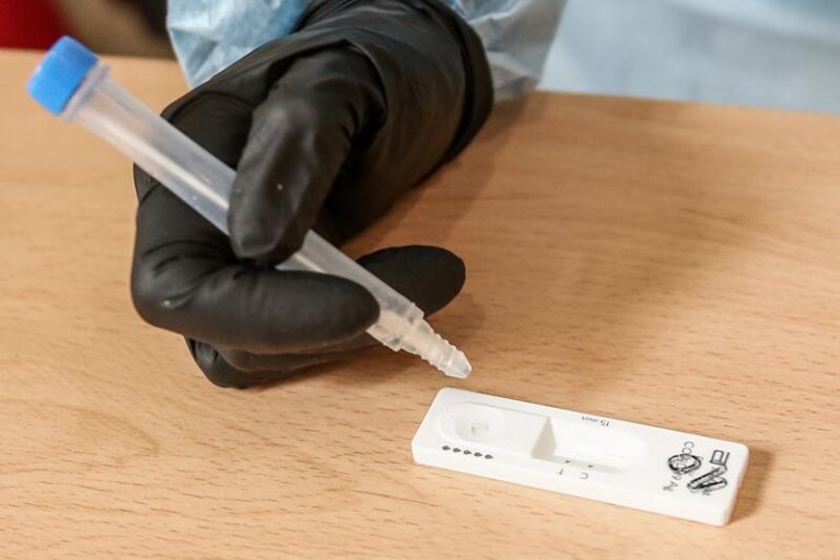 Madrid notifica 646 casos, 524 de las últimas 24 horas, y 11 fallecidos