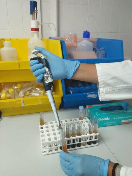 Pacientes con hipercolesterolemia familiar denuncian que es un problema de salud «muy poco reconocido