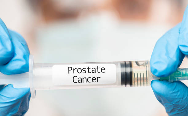 Dosis Cancer De Prostata