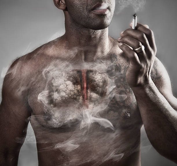 Foto Ilustrada Cancer De Pulmon