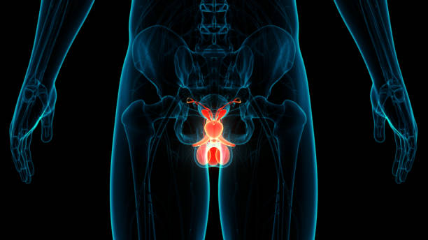 Ilustracion Cancer De Prostata