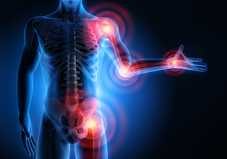 ¿Cómo Se Diagnóstica El Dolor Neuropático?