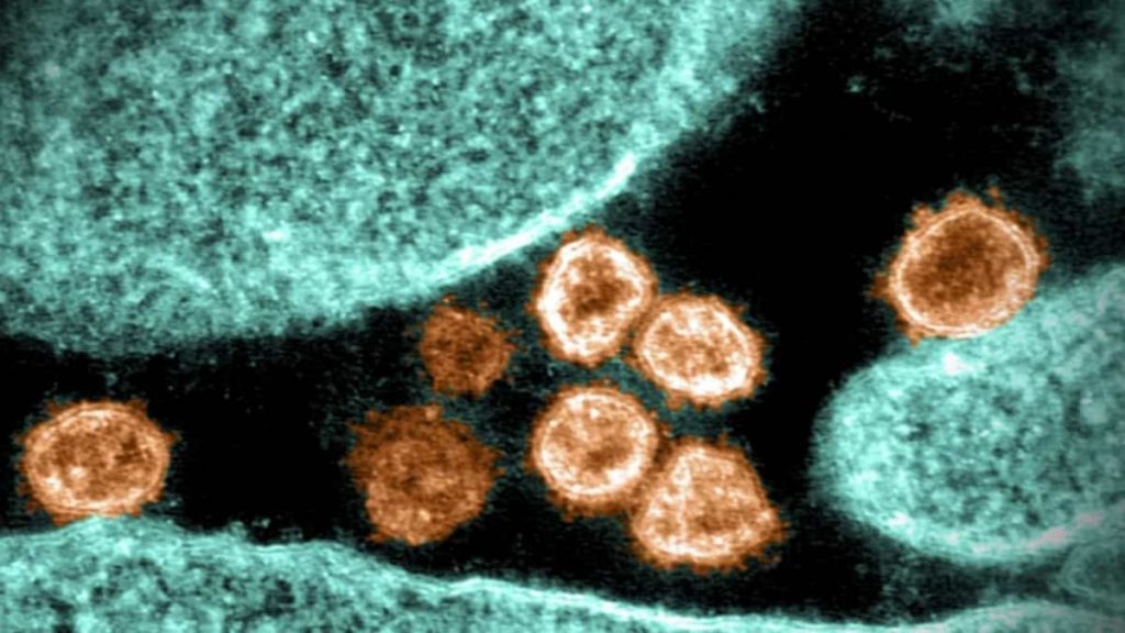 ¿Cuándo Fue Identificada La Nueva Variante Del Virus Covid Apodada Como “Mu”?
