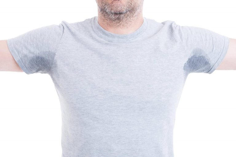 La forma segura de tratar la sudoración excesiva o hiperhidrosis en Clínica Fercasy