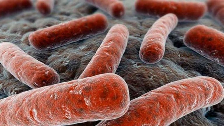 MSF: El alarmante frenazo en los diagnósticos de la tuberculosis está costando miles de vidas