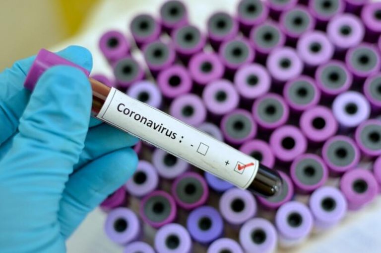 Castilla-La Mancha registra 74 nuevos casos y un fallecido en las últimas 24 horas