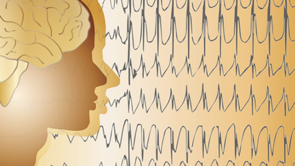 Qué Es Y Por Qué Se Produce La Epilepsia 2 ¿Cuáles Son Los Tipos De Epilepsia?