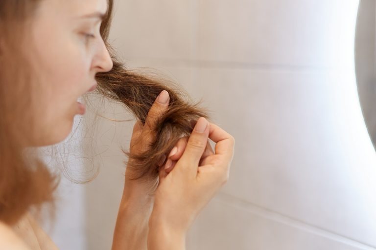 Cómo usar el aceite de coco para eliminar la caspa del cabello