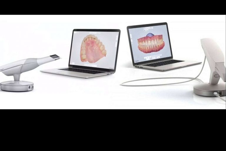 Toma de registros con 3Shape TRIOS, un escáner de última tecnología en la clínica dental Implant Clinics