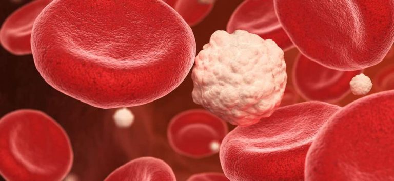 Este es el alimento que te hará bajar el azúcar en sangre