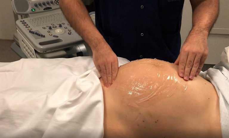 ¿Tu bebé viene de nalgas? ¡No te preocupes! Hay una maniobra que puede evitar la cesárea