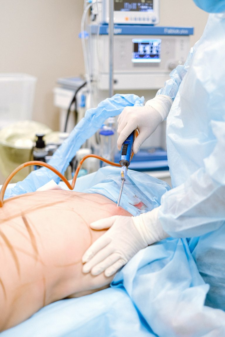 Qué es una liposucción y cómo se hace