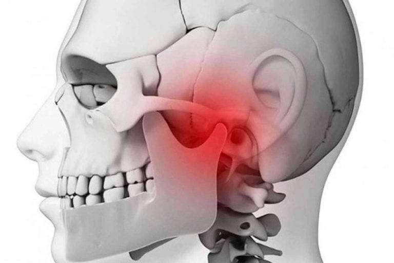 Las lesiones de la articulación temporomandibular o ATM tratadas con osteopatía