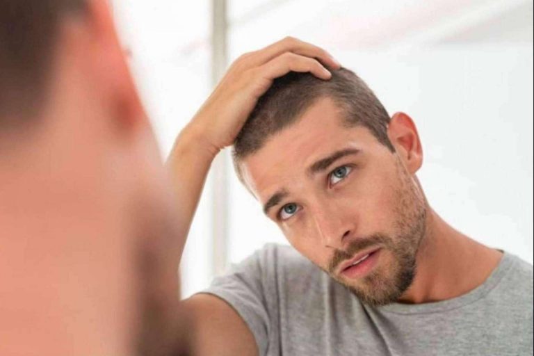 Adiós a la caída del cabello con los tratamientos de Clínica Tarrazo