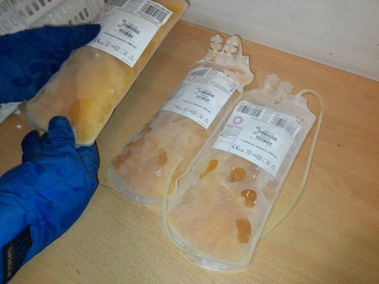 El plasma de pacientes recuperados de COVID-19 podría ayudar a evitar la hospitalización