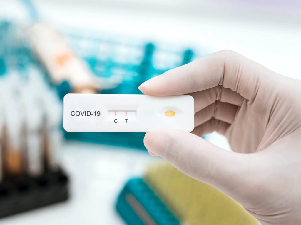 ¿Hay Diferencias Entre Una Pcr Y Un Test De Antígenos?