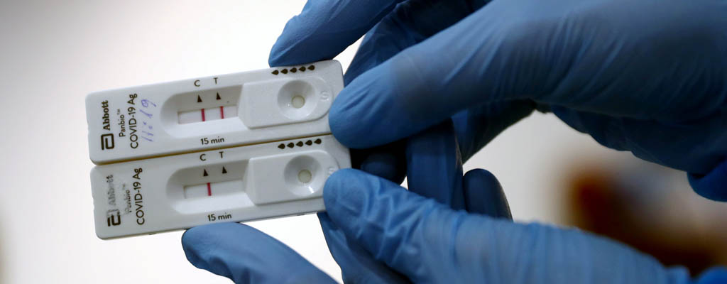 ¿Los Análisis Serológicos Detectan El Covid- 19?