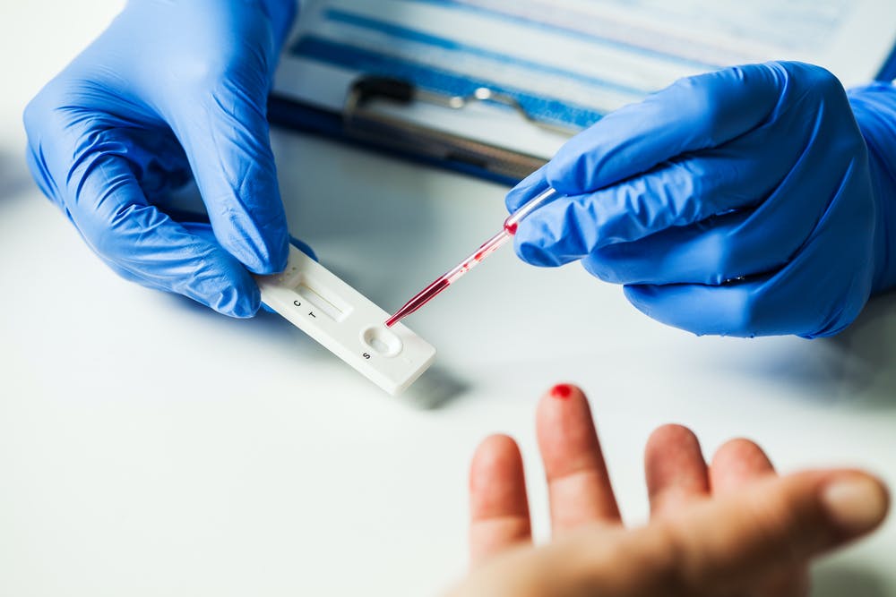 ¿El Resultados Del Test De Antígenos Es Fiable?