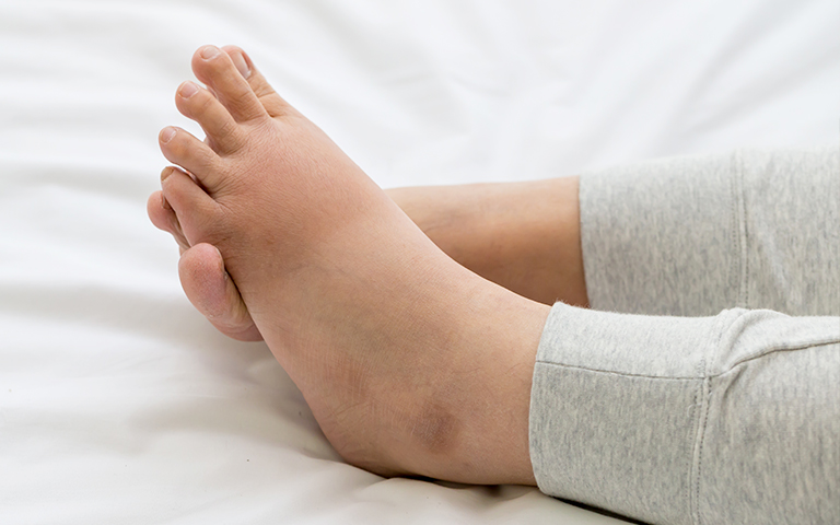 ¿Es Riesgoso Que Los Pies Se Duermen?