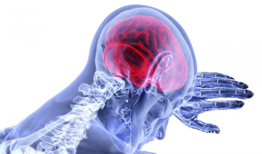 ¿Qué Son Los Anticoagulantes Usados Antes Un Ictus?