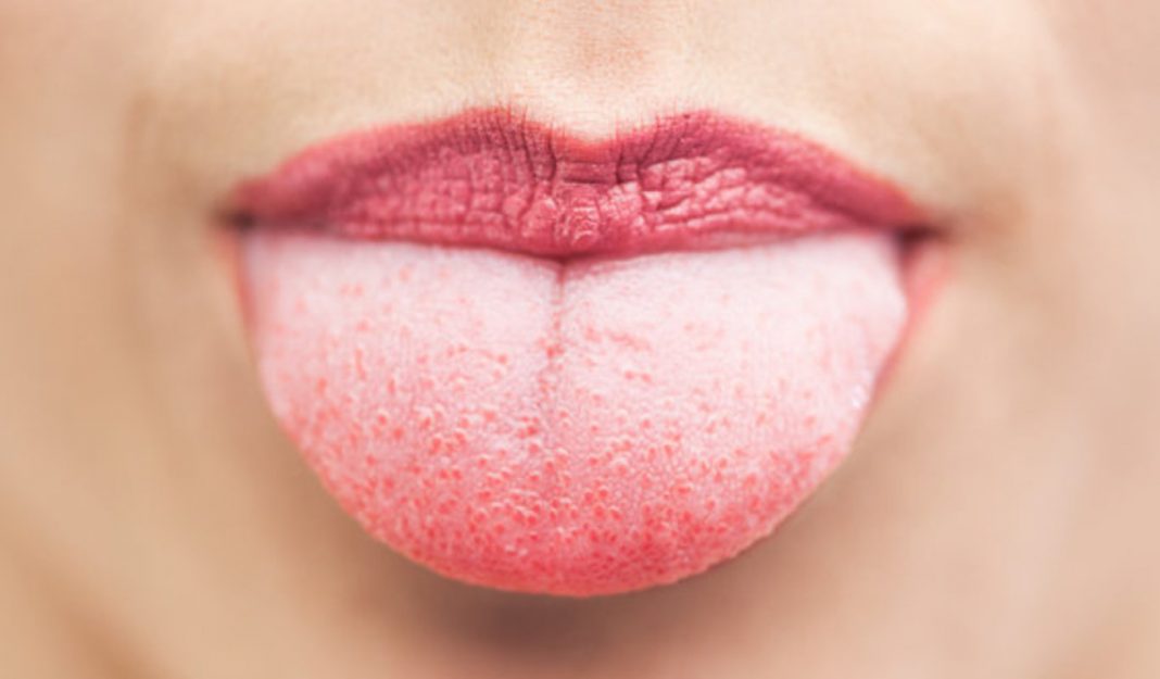 Esto es lo que dice tu lengua de tu salud