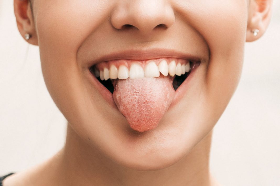 Esto es lo que dice tu lengua de tu salud