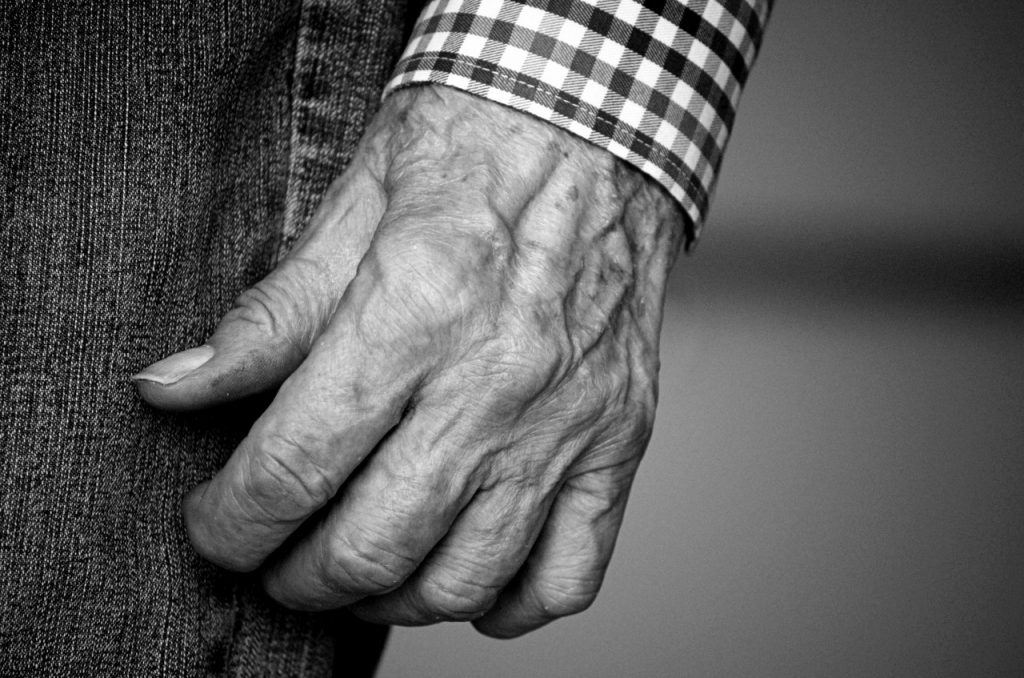¿Cuál Es El Pronóstico Para Un Paciente Con Artritis Reumatoide?