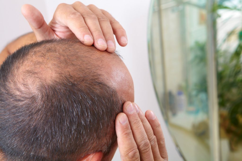 La Aparición De Canas, El Síntoma Más Notorio Del Envejecimiento Del Cabello