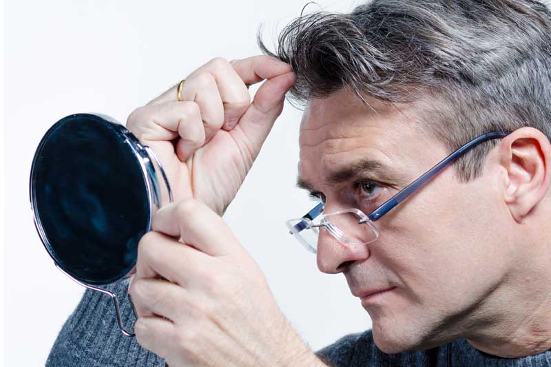 Si tienes canas no te quedas calvo: ¿verdad o mentira?