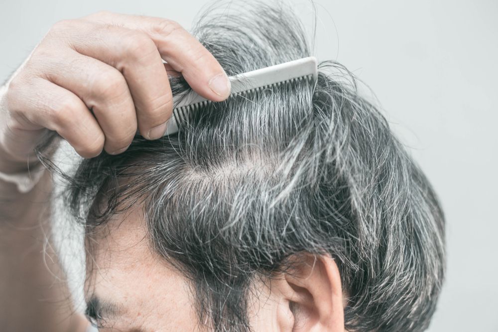 Si tienes canas no te quedas calvo: ¿verdad o mentira?