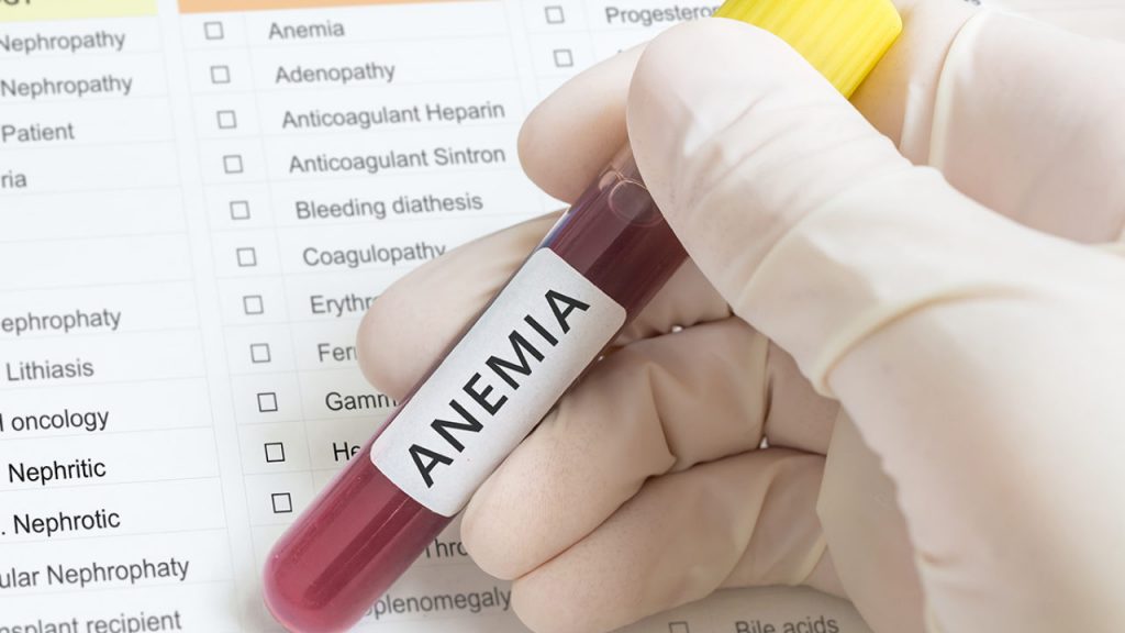 Síntomas Que Te Avisan De Que Tienes Anemia
