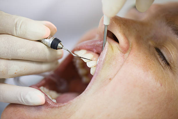 Los implantes dentales pueden llegar a generar enfermedades