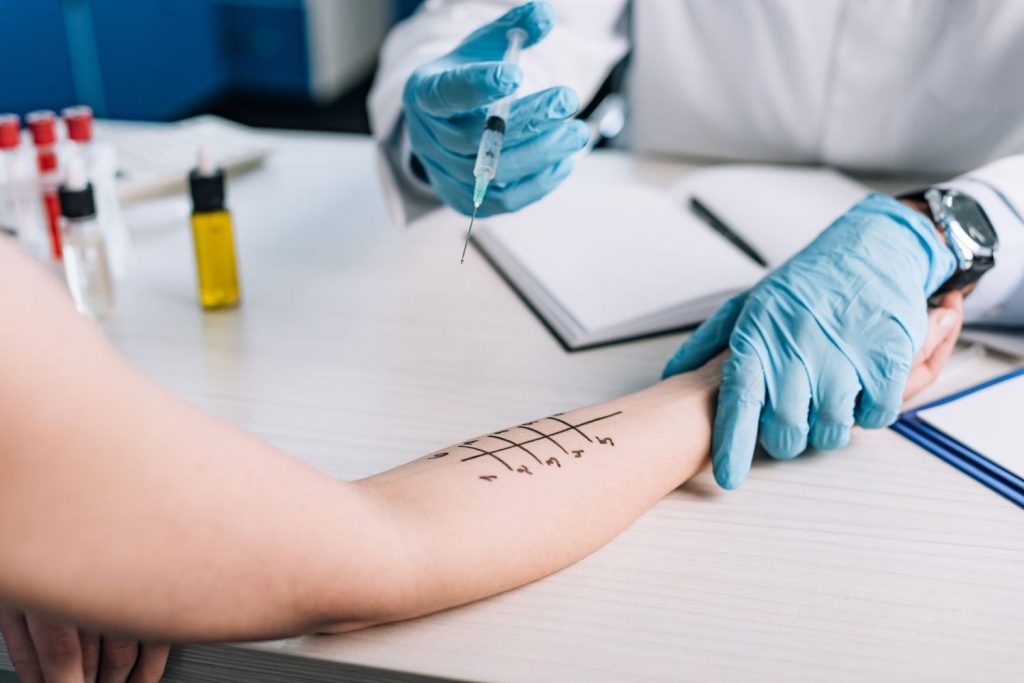Prueba Alergia Al Latex