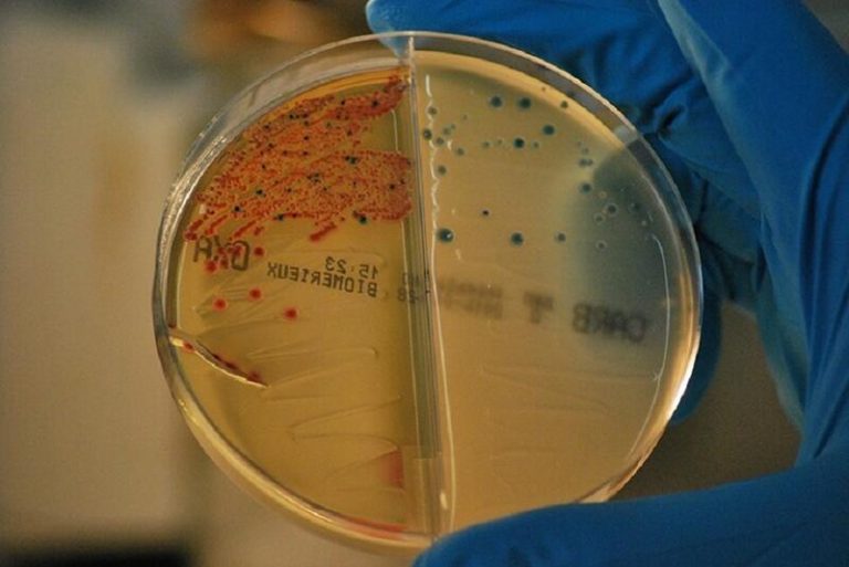 Un nuevo tipo de antibiótico puede combatir las bacterias resistentes que no responden a otros tratamientos