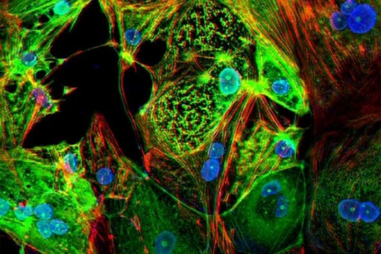 Ómicron es menos eficaz para causar enfermedad grave que otras variantes