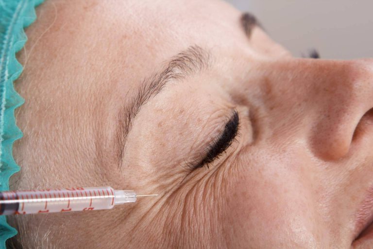 El tratamiento de lifting facial sin cirugía, por Policlínica ICD