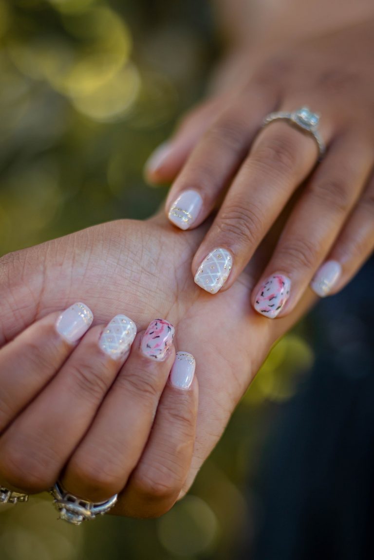 10 señales en tus uñas que detectan enfermedades