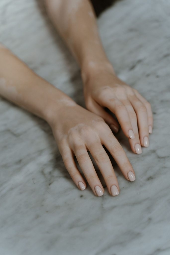 Qué Indica Una Línea Negra En Tus Uñas