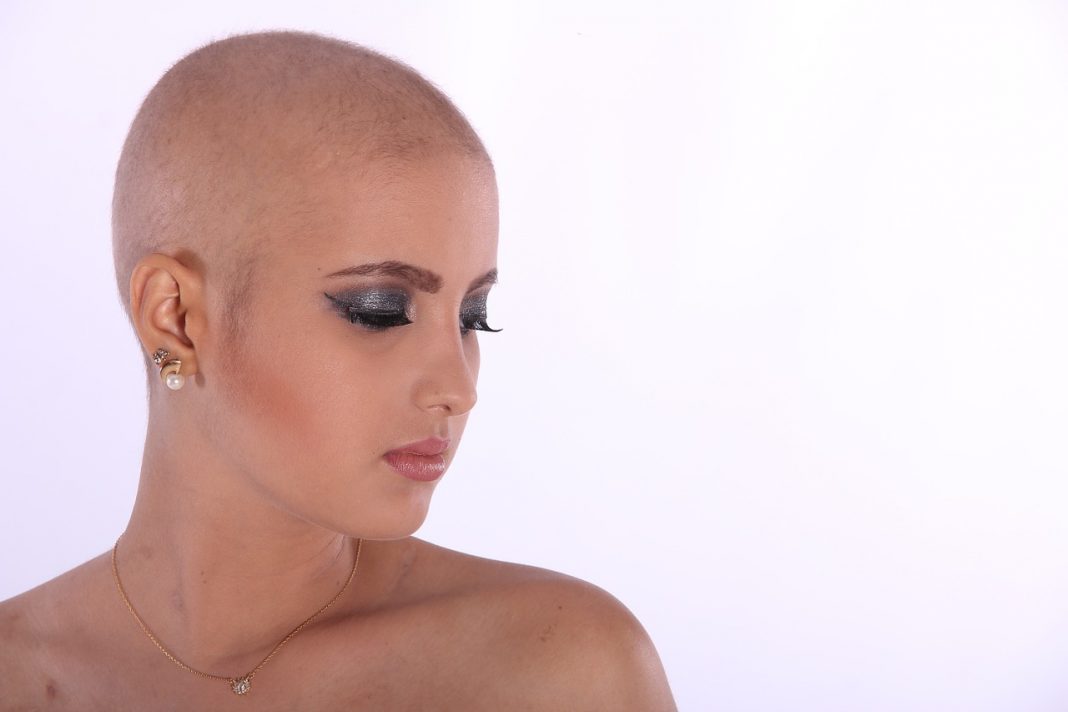 En busca del 'pelo infinito': tratamientos efectivos para no ser calvo