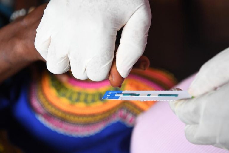 Las mujeres con VIH en España se diagnostican más tarde que los hombres