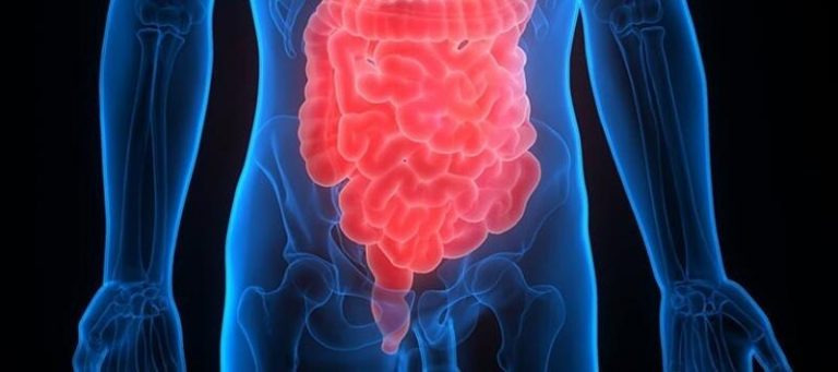 Identifican nuevas dianas para la inmunoterapia en el cáncer de colon