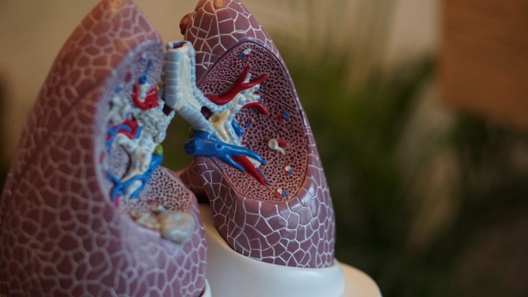 Cáncer de pulmón: síntomas que avisan de un problema