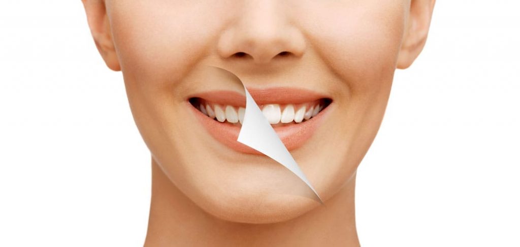 Remedios Caseros Para Los Dientes Amarillos